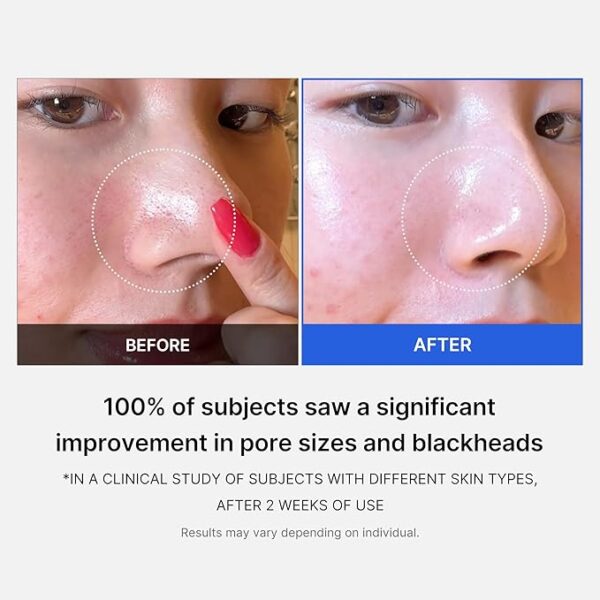 Limited time deal 51% off Medicube Zero Pore Pads 2.0 - Image 2